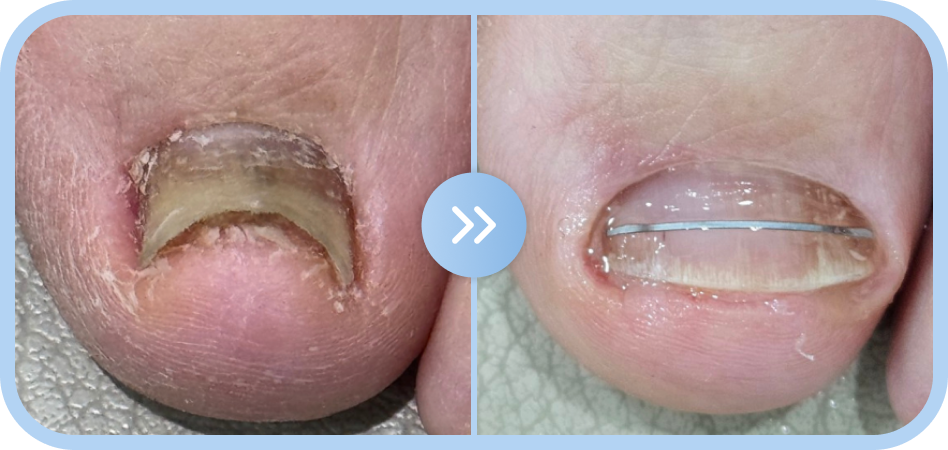 약 3개월 관리과정