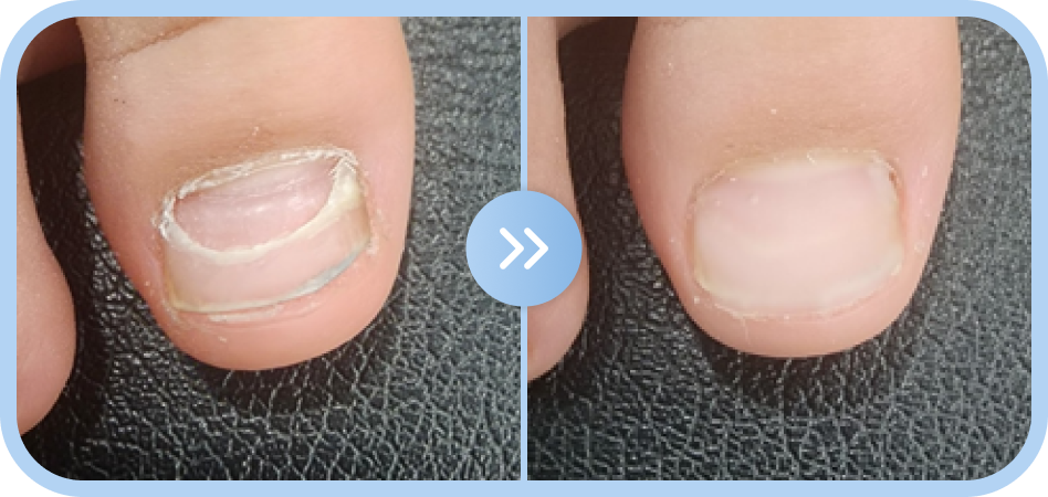 복원 전 > 복원 후